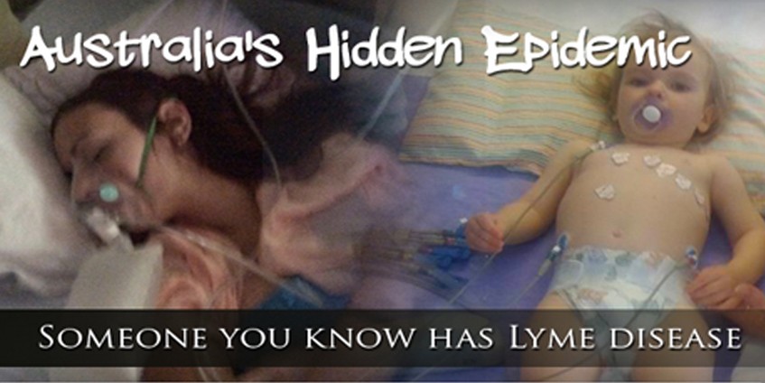 Australia's hidden epidemic Someone you know Lyme disease
