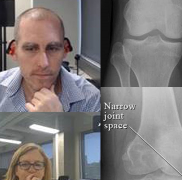 Two doctors on webcam reviewing xrays online