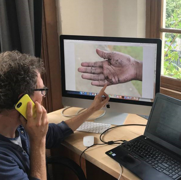 Man on phone diagnosing a hand on computer screen. Dr John Kelly conducting a telehealth consultation.