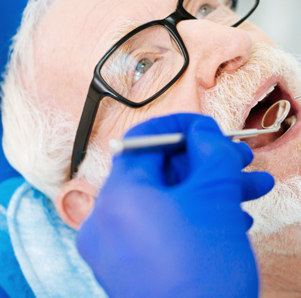 Man getting his teeth checked